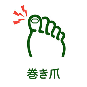 巻き爪