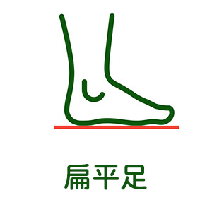 扁平足