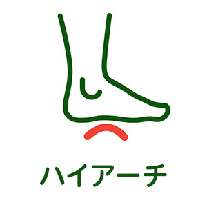 ハイアーチ